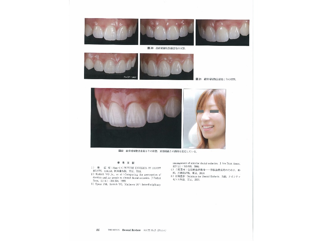 『日本歯科評論（THE NIPPON　Dental Review）』2015年5月号／別刷／ページ12