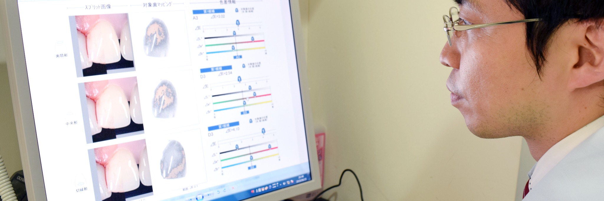 シェードテイキングの様子
