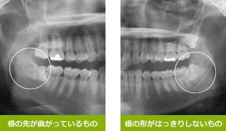 口腔外科 仙台市泉区泉中央の歯医者 とがし歯科クリニック