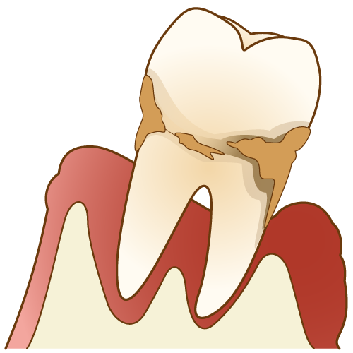 歯周内科 秋田県横手市の歯医者 ささき歯科医院