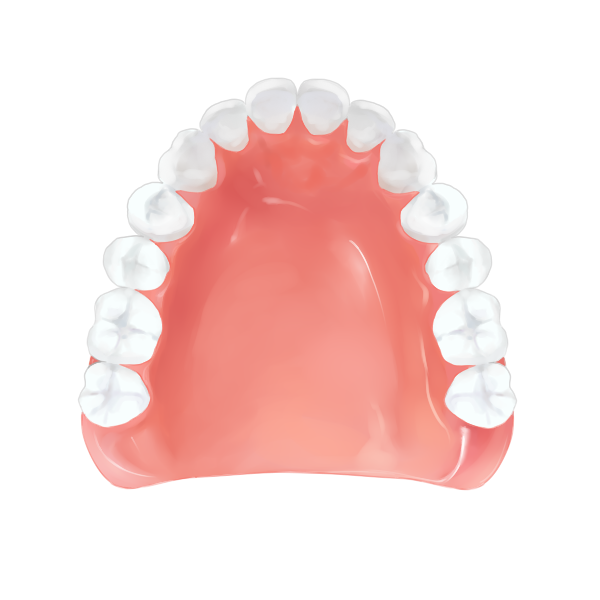 レジン床義歯（入れ歯） – 保険適応 -