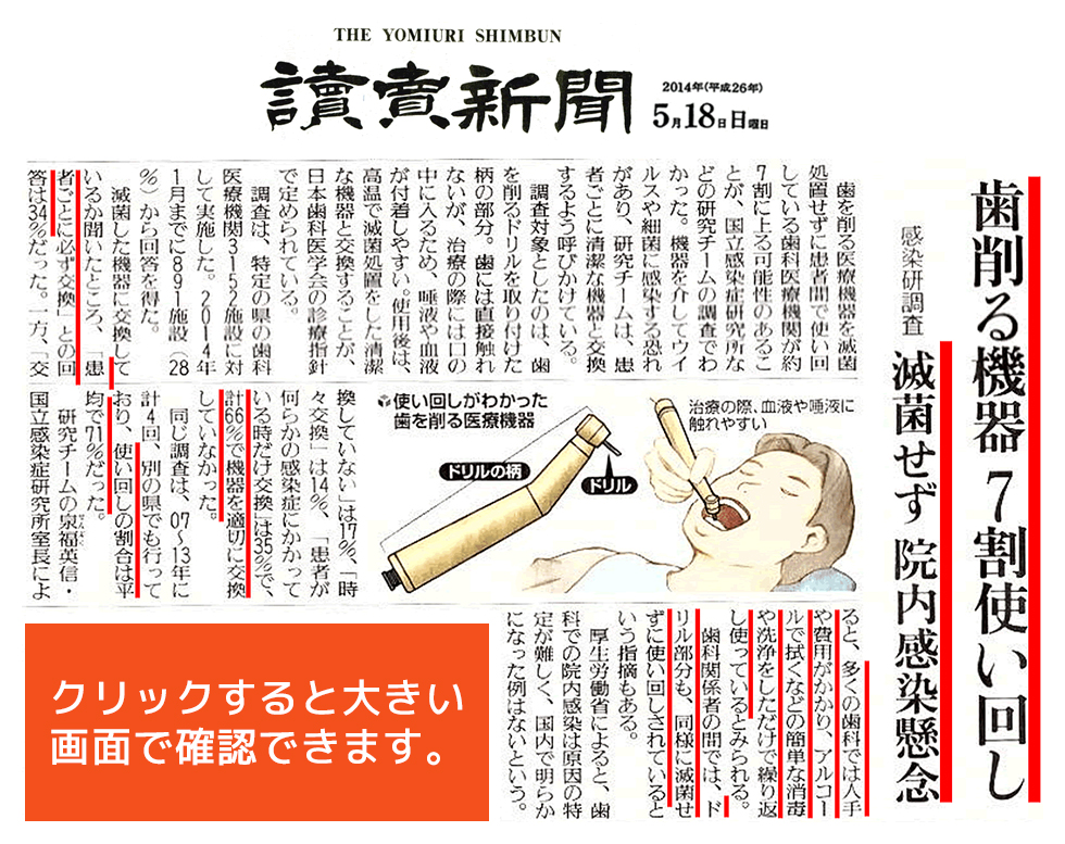 讀賣新聞 2014年(平成26年)5月18日 日曜日 「歯を削る機器7割使い回し ~感染研調査 滅菌せず院内感染懸念~」