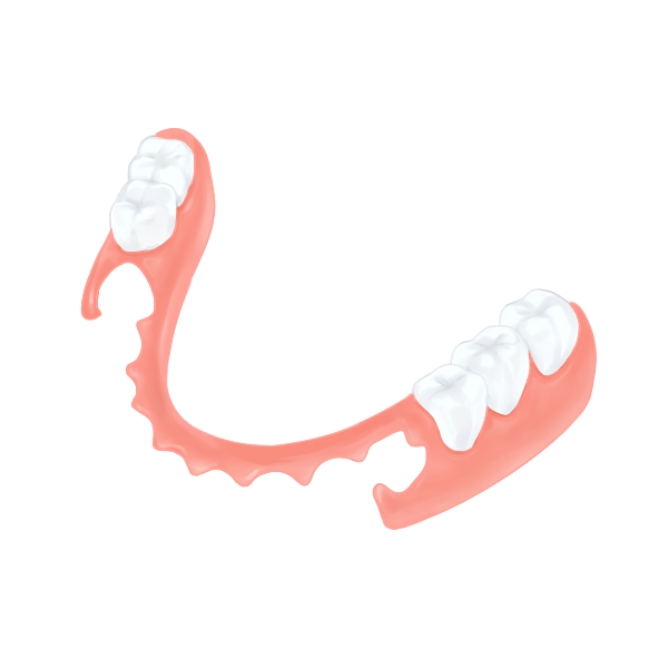 ノンクラスプ義歯（入れ歯）