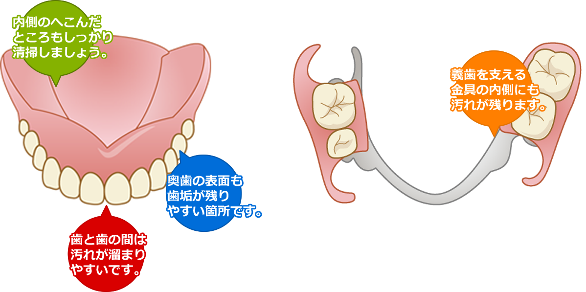 義歯 入れ歯 明本歯科医院