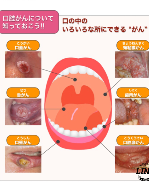 ん 口腔 が 口腔機能の健康への影響