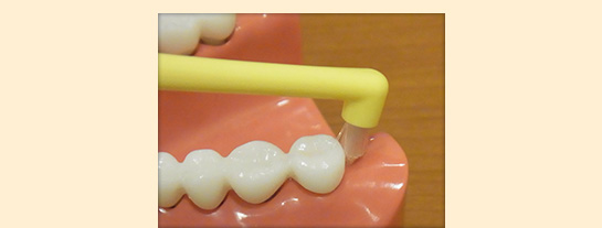 歯並びが凸凹している所の磨き方