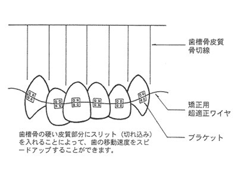 矯正歯科 - 渡辺歯科クリニック